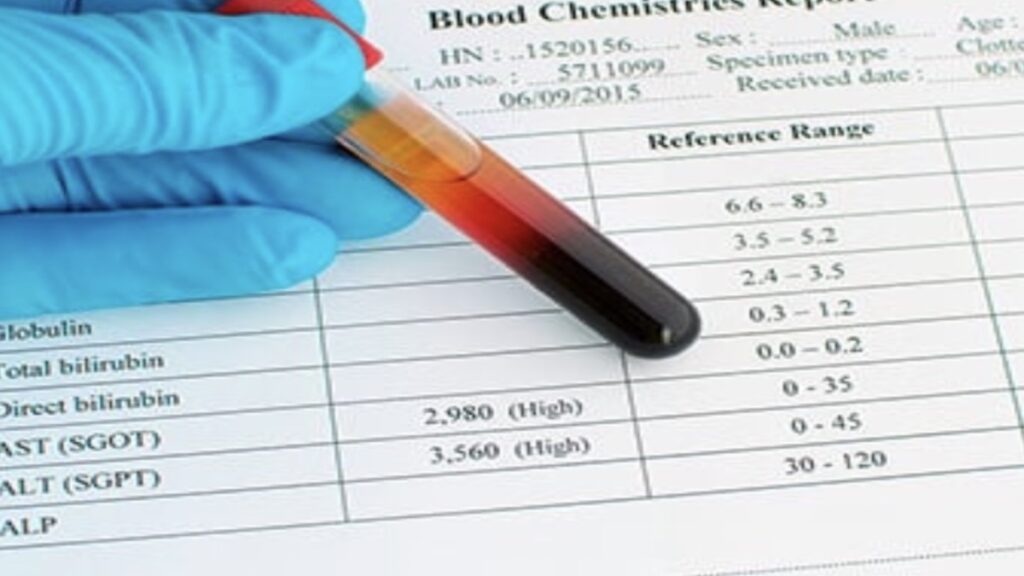 رموز تحليل الدم
