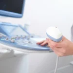 اشعة التراساوند