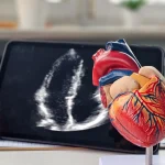 اشعة مقطعية بالصبغة على القلب