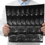 اشعة مقطعية للبطن والحوض بالصبغة