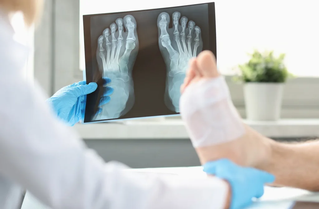 أشعة دوبلر على الرجل
