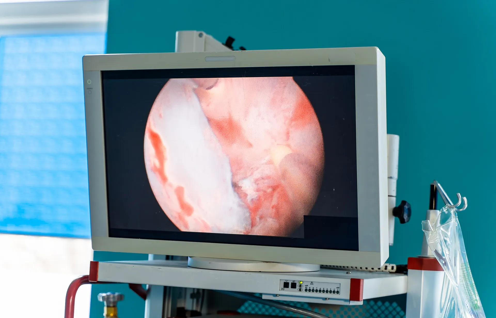 أشعة دوبلر على الشرايين والأوردة